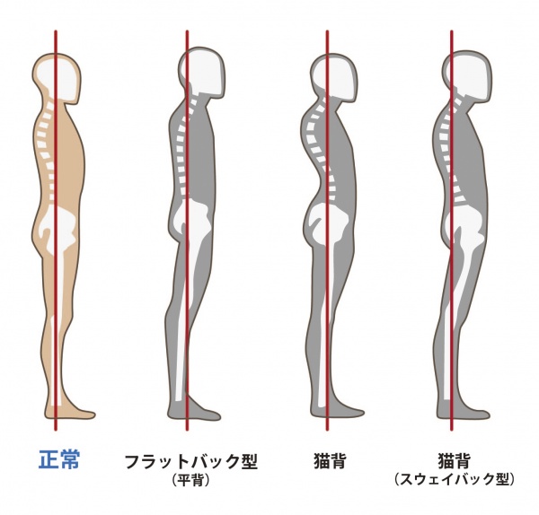 あなたの姿勢はどんな姿勢ですか？